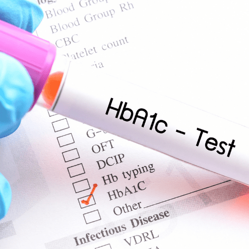 Controlling HgBA1C with Medications Does not Make Diabetes Disappear – it Lowers the Surrogate Marker HgBA1C