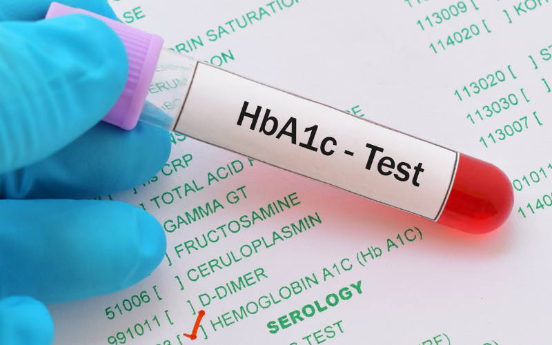 Controlling HgBA1C with Medications Does not Make Diabetes Disappear – It Lowers the Surrogate Marker HgBA1C